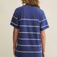 Z Supply - Sway Stripe Mini Dress