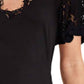Generation Love - Shin Lace Combo Mini Dress