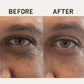 Papatui Ageless Action Technology Under Men's Eye Patch 6ct - Imperfect Box