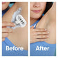 Venus Extra Smooth Sensitive Value Pack Women's Razor + 3 Razor Blade Refills - Missing Box