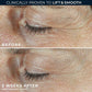 RoC Derm Correxion Dual Eye Cream 0.68 fl oz - Imperfect Box