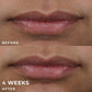 RoC Derm Correxion Lip Volumizer Treatment 0.34 fl oz - Imperfect Box
