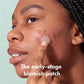 Hero Mighty Patch Micropoint for Blemishes 8ct - Imperfect Box