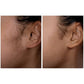 Spa Sciences SIMA Deluxe Sonic Dermaplaning Tool for Exfoliation & Peach Fuzz Removal - Imperfect Box