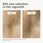 Nood The Flasher 2.0 IPL Permanent Hair Removal - Imperfect Box