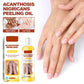 Acanthosis Nigricans Peeling Oil for Dark Spots 110ml