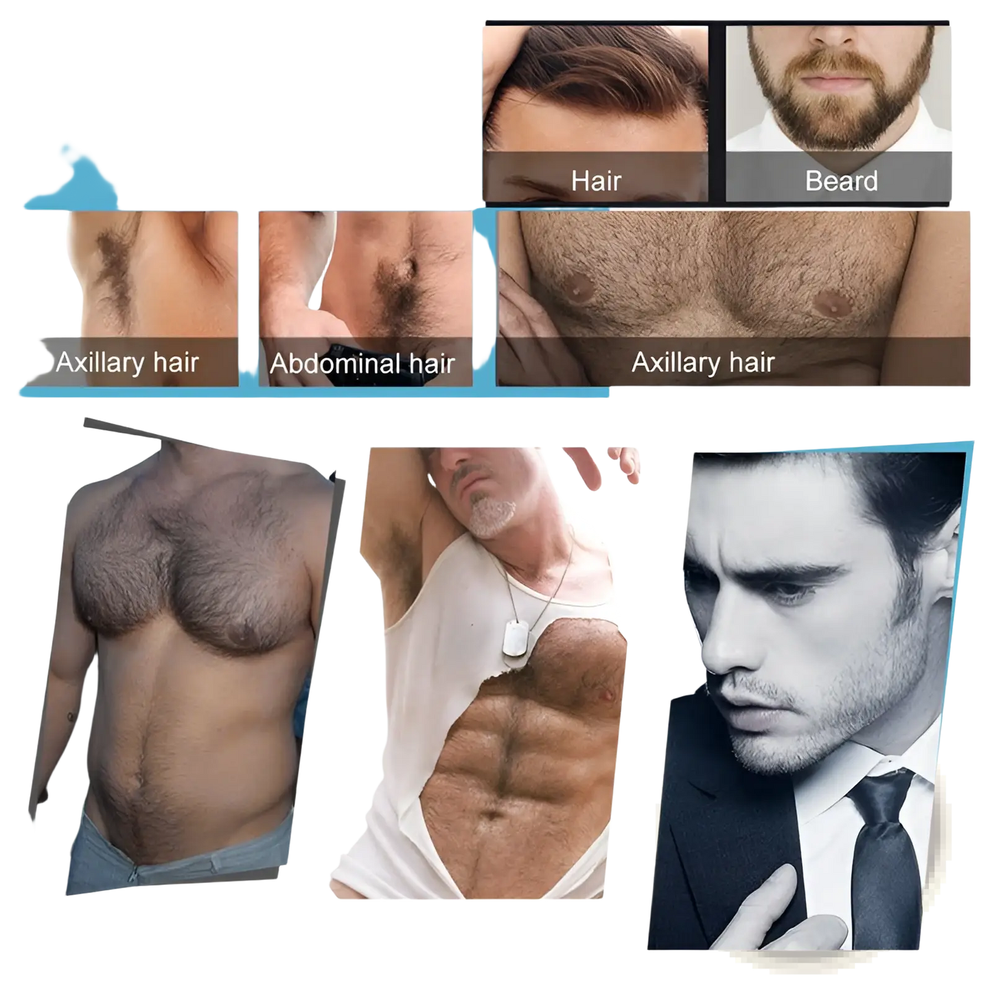 Beard Growth Kit with Derma Roller and Serum Set