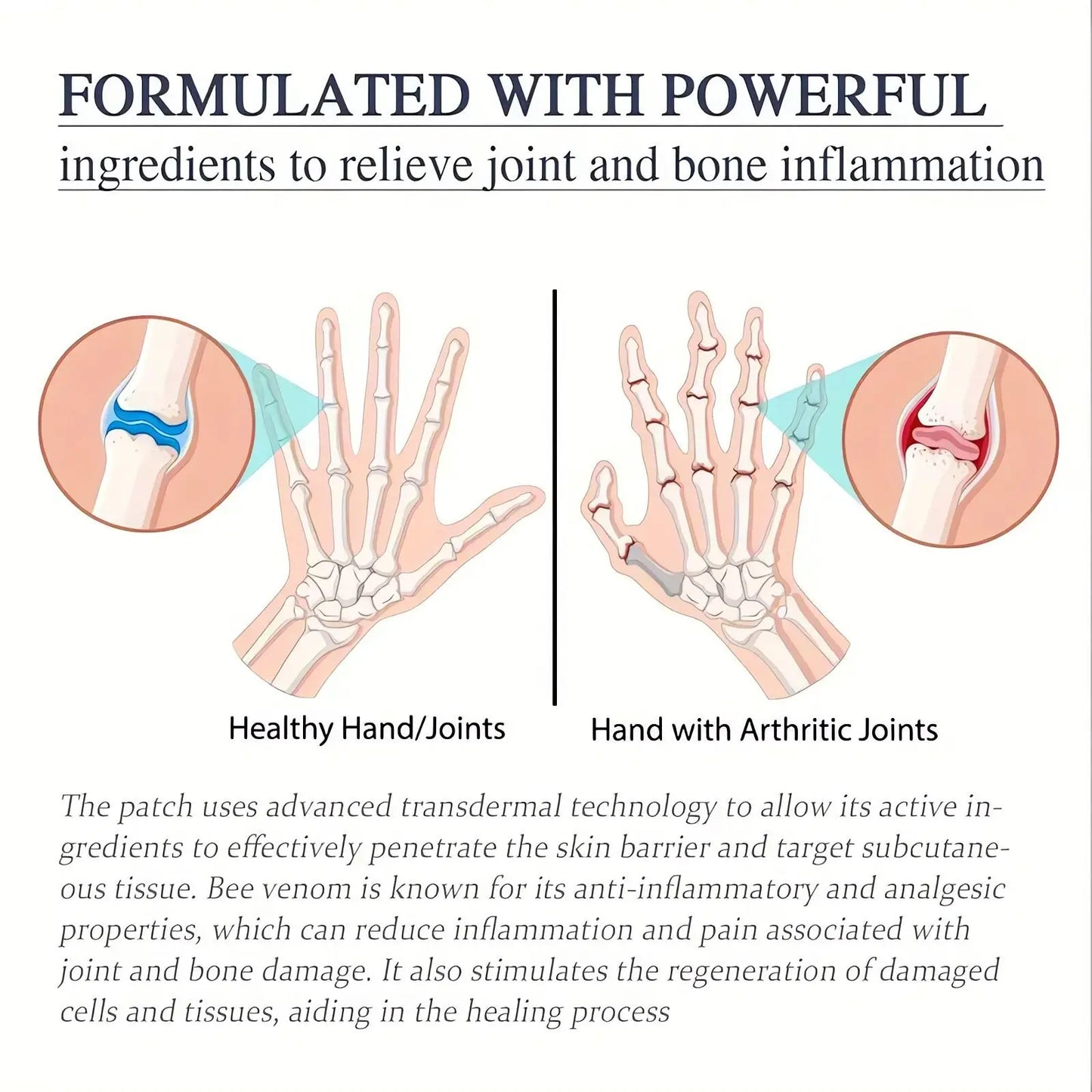 Bee Venom Joint Relief Cream for Inflammation 60g