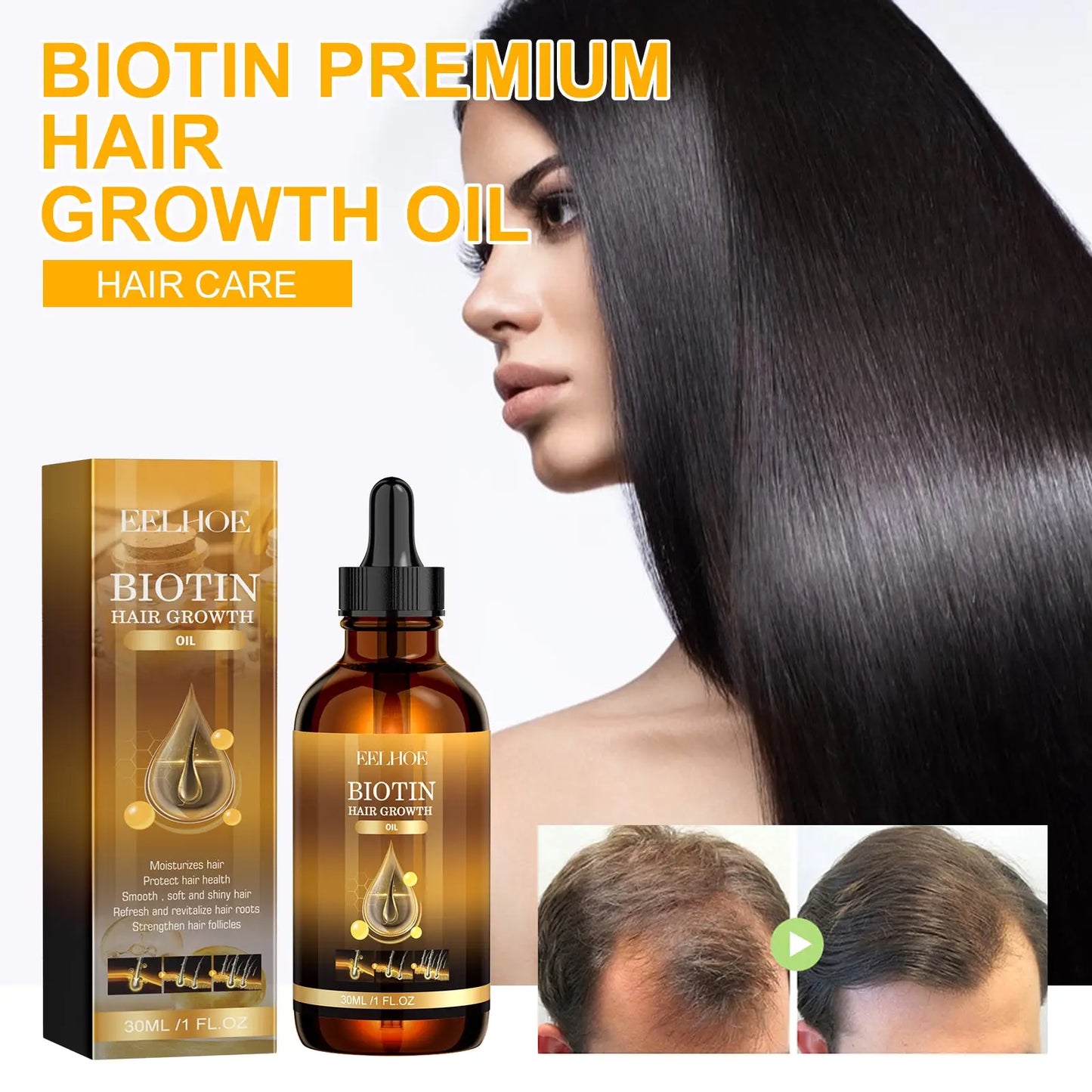 Eelhoe Biotin Hair Growth Oil with Rosemary and Castor Oil