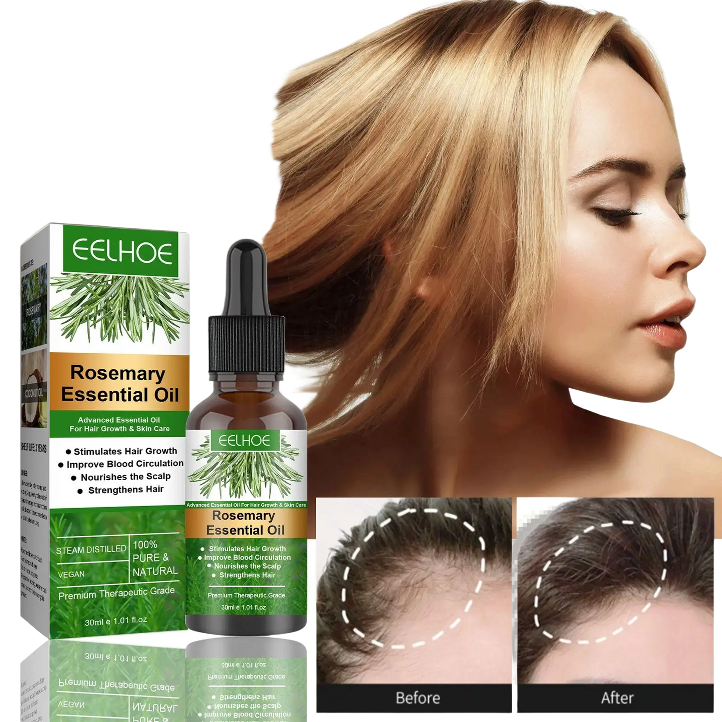 Eelhoe Rosemary Hair Growth Oil and Dermaroller Set