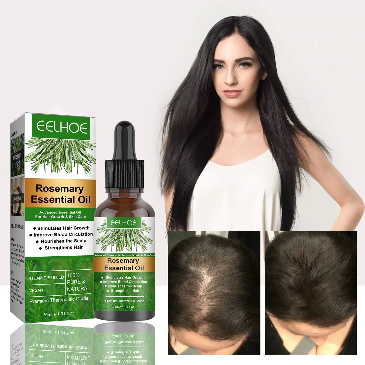 Eelhoe Rosemary Hair Growth Oil and Dermaroller Set