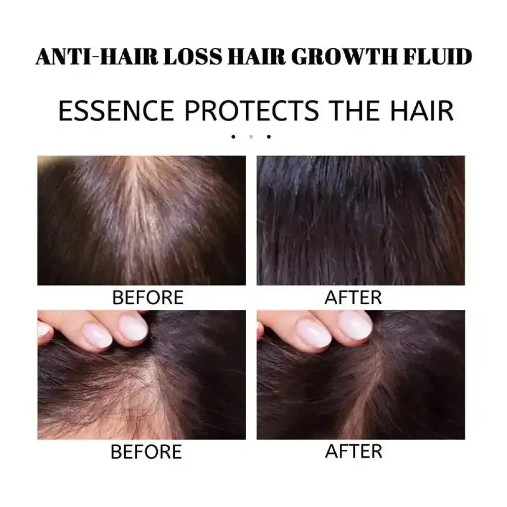 Carvenchy Rosemary Mint Hair Strengthening and Growth Oil