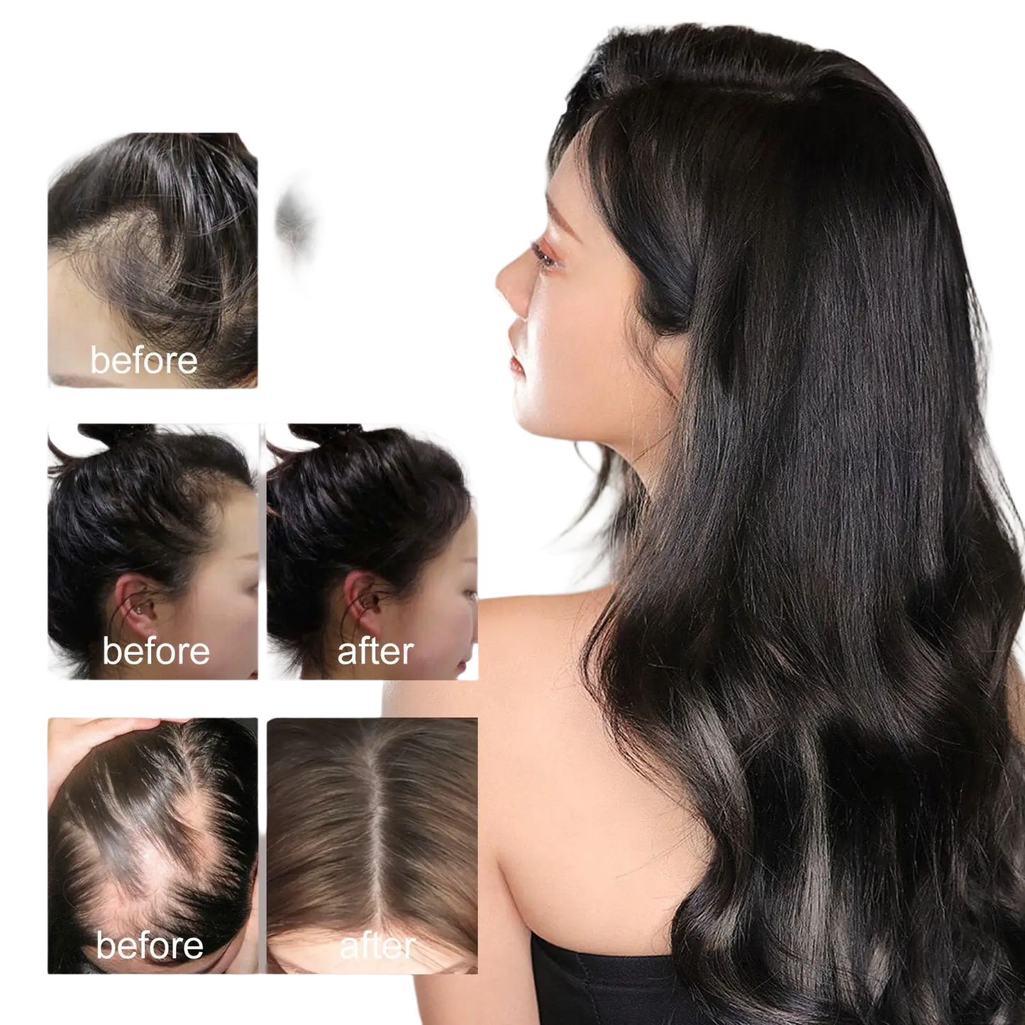 Hair Growth Serum Anti Hair Fall Oil 30ml