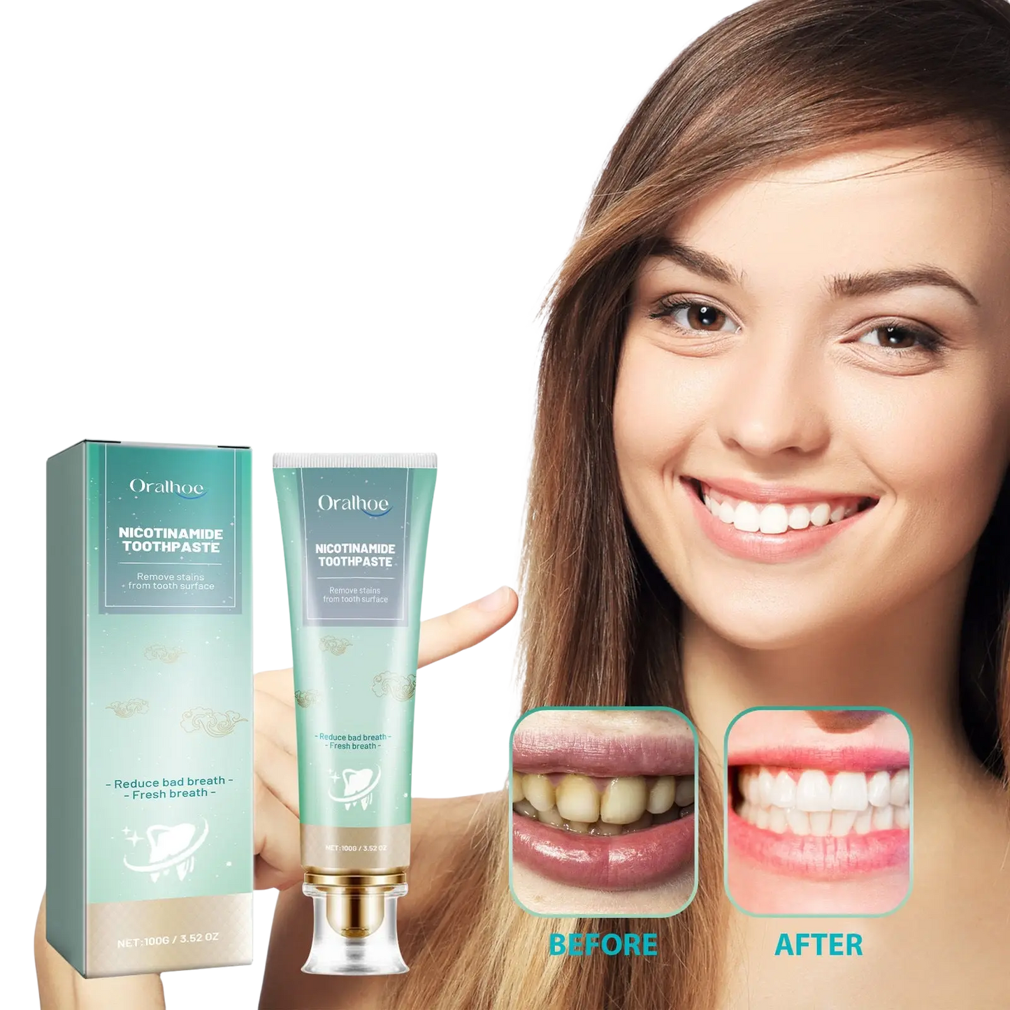 Nicotinamide Teeth Whitening Toothpaste Stain Removal 100g