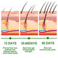 Eelhoe Rosemary Essential Oil for Hair Growth and Scalp Care