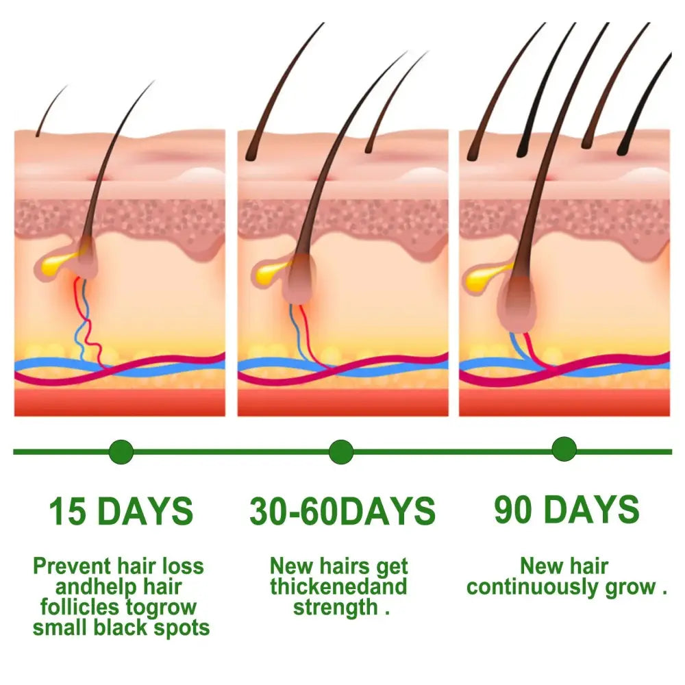 Eelhoe Rosemary Essential Oil for Hair Growth and Scalp Care